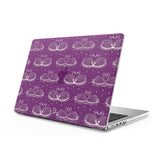 Loyalty - Clear MacBook Case (Glitter)
