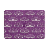 Loyalty - Clear MacBook Case (Glitter)