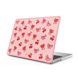 Sweet Bond - Clear MacBook Case