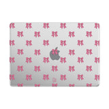 Surprise - Clear MacBook Case