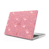 Pink Romance - Clear MacBook Case (Glitter)