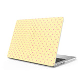 Yellow Pink - Clear MacBook Case