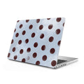 Lakes - Clear MacBook Case