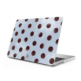 Lakes - Clear MacBook Case