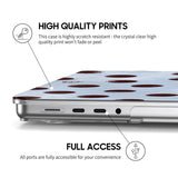 Lakes - Clear MacBook Case