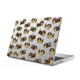 Follow Me - Clear MacBook Case