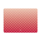 Shy - Clear MacBook Case