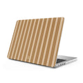 Khaki - Clear MacBook Case