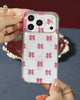 Surprise - iPhone Case
